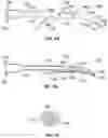 Fig. 10 - SYSTEM FOR RESTORING PATENCY ACROSS AN OBSTRUCTION