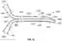 Fig. 11 - SYSTEM FOR RESTORING PATENCY ACROSS AN OBSTRUCTION