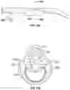 Fig. 14 - SYSTEM FOR RESTORING PATENCY ACROSS AN OBSTRUCTION