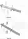 Fig. 17 - Aspiration thrombectomy system and methods for thrombus removal with aspiration catheter