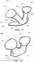 Fig. 09 - Device and method for treating nosebleeds