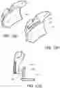 Fig. 11 - Device and method for treating nosebleeds