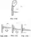 Fig. 18 - Device and method for treating nosebleeds