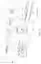 Fig. 03 - Medical probe having improved maneuverability