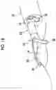 Fig. 18 - TREATMENT TOOL FOR ENDOSCOPE