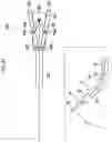 Fig. 41 - TREATMENT TOOL FOR ENDOSCOPE