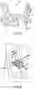 Fig. 08 - RESISTING TORQUE IN ARTICULATING SURGICAL TOOLS