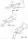 Fig. 16 - Needle assembly with reverberation features to facilitate ultrasound guidance