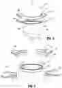 Fig. 04 - Surgical access device with fixation mechanism