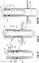 Fig. 15 - Surgical access device with fixation mechanism