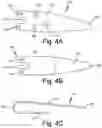 Fig. 05 - SURGICAL INSTRUMENT FOR A SUBCUTANEOUS DEVICE
