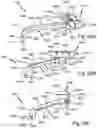 Fig. 100 - SURGICAL INSTRUMENT FOR A SUBCUTANEOUS DEVICE