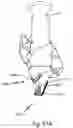 Fig. 102 - SURGICAL INSTRUMENT FOR A SUBCUTANEOUS DEVICE