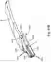 Fig. 103 - SURGICAL INSTRUMENT FOR A SUBCUTANEOUS DEVICE