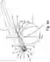 Fig. 12 - SURGICAL INSTRUMENT FOR A SUBCUTANEOUS DEVICE