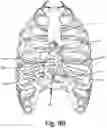 Fig. 13 - SURGICAL INSTRUMENT FOR A SUBCUTANEOUS DEVICE
