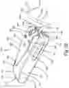 Fig. 28 - SURGICAL INSTRUMENT FOR A SUBCUTANEOUS DEVICE