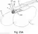 Fig. 34 - SURGICAL INSTRUMENT FOR A SUBCUTANEOUS DEVICE