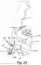 Fig. 44 - SURGICAL INSTRUMENT FOR A SUBCUTANEOUS DEVICE