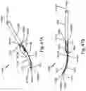 Fig. 78 - SURGICAL INSTRUMENT FOR A SUBCUTANEOUS DEVICE