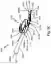 Fig. 87 - SURGICAL INSTRUMENT FOR A SUBCUTANEOUS DEVICE