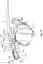 Fig. 98 - SURGICAL INSTRUMENT FOR A SUBCUTANEOUS DEVICE