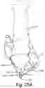 Fig. 40 - SURGICAL INSTRUMENT FOR A SUBCUTANEOUS DEVICE