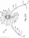 Fig. 50 - SURGICAL INSTRUMENT FOR A SUBCUTANEOUS DEVICE