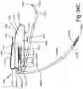 Fig. 58 - SURGICAL INSTRUMENT FOR A SUBCUTANEOUS DEVICE