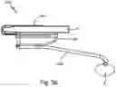 Fig. 65 - SURGICAL INSTRUMENT FOR A SUBCUTANEOUS DEVICE