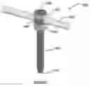 Fig. 24 - COMPOSITE MATERIAL SPINAL IMPLANT