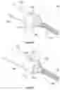 Fig. 52 - COMPOSITE MATERIAL SPINAL IMPLANT