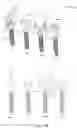 Fig. 75 - COMPOSITE MATERIAL SPINAL IMPLANT