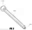 Fig. 06 - Medical device and method to correct deformity