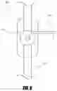 Fig. 09 - Medical device and method to correct deformity
