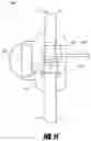 Fig. 11 - Medical device and method to correct deformity