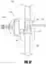 Fig. 12 - Medical device and method to correct deformity