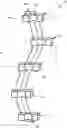 Fig. 01 - Patient-specific jig for personalized surgery