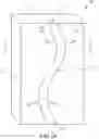 Fig. 04 - Patient-specific jig for personalized surgery