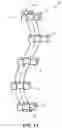 Fig. 06 - Patient-specific jig for personalized surgery
