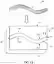 Fig. 08 - Patient-specific jig for personalized surgery