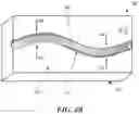 Fig. 09 - Patient-specific jig for personalized surgery