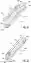 Fig. 19 - Intramedullary implant and method of use