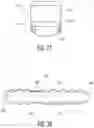Fig. 23 - Intramedullary implant and method of use