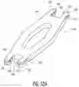 Fig. 31 - Intramedullary implant and method of use