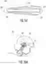 Fig. 36 - Intramedullary implant and method of use