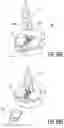 Fig. 38 - Intramedullary implant and method of use