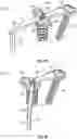 Fig. 03 - Modular bone implant devices and means of insertion