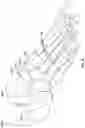 Fig. 12 - Modular bone implant devices and means of insertion