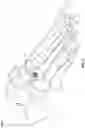 Fig. 18 - Modular bone implant devices and means of insertion